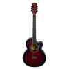 Guitarra acustica alicante A ST RD, Aranjuez-0
